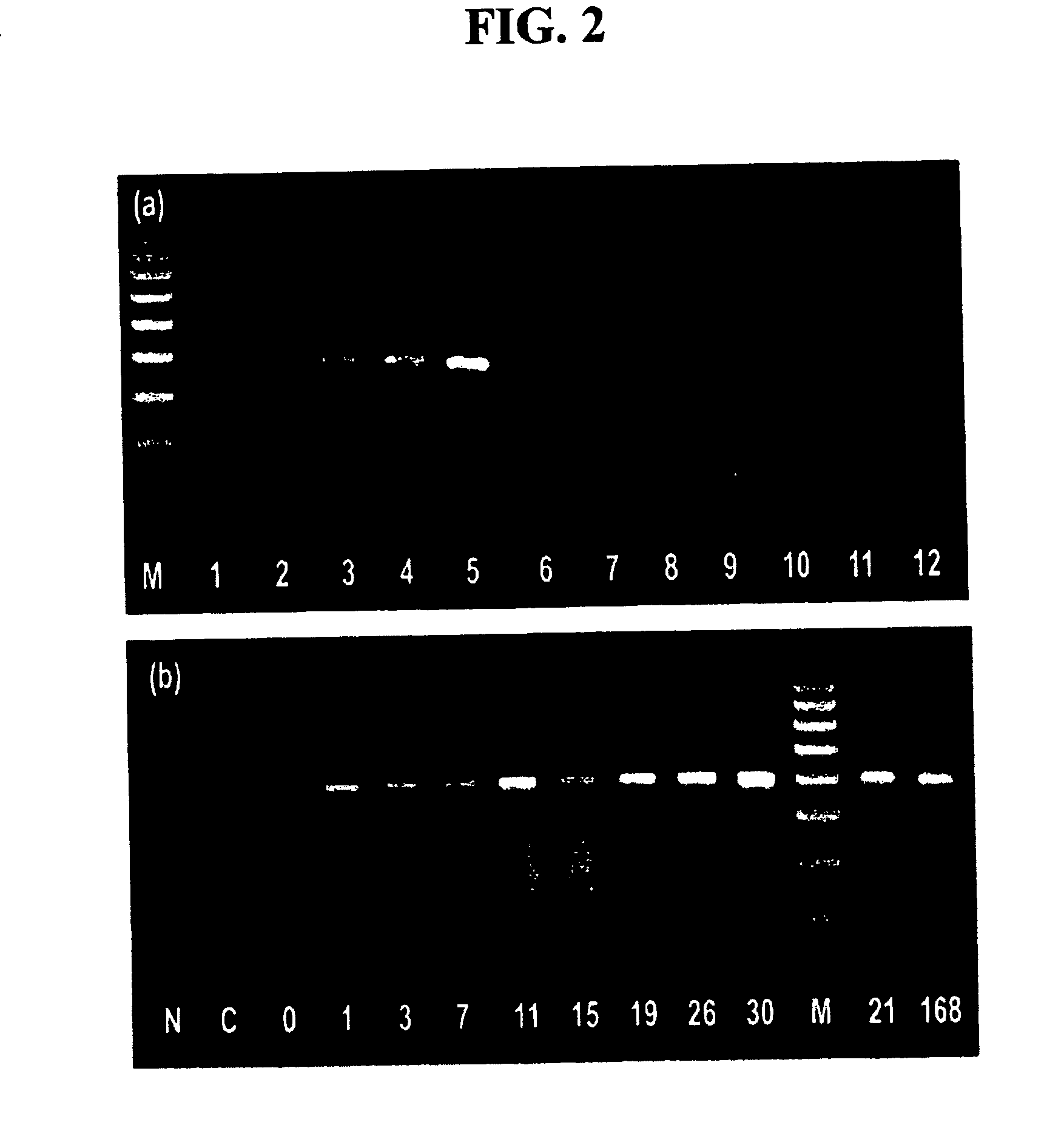Recombinant peptide vector comprising the gene for treatment for autoimmune diseases