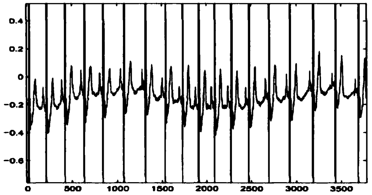 Method for obtaining standard parameter range of adult Chinese rural dog electrocardiogram