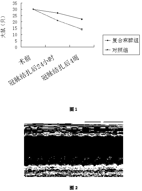 Composite anesthetic, preparation method thereof, and use thereof in myocardial infarction animal model