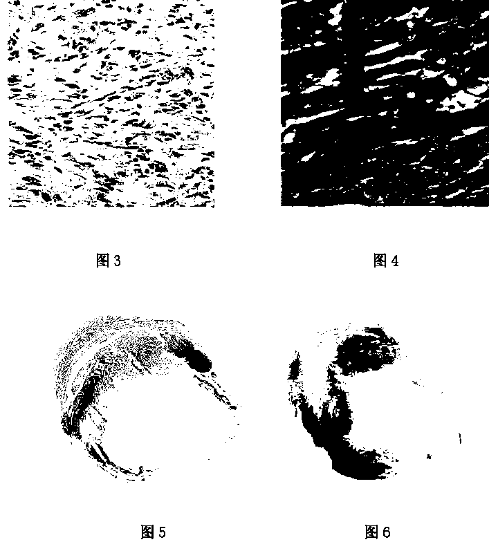 Composite anesthetic, preparation method thereof, and use thereof in myocardial infarction animal model