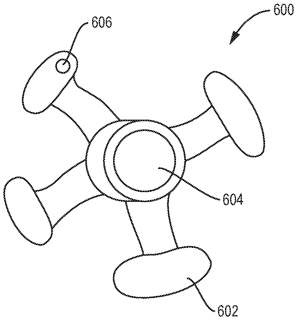 Patient-specific prosthesis alignment