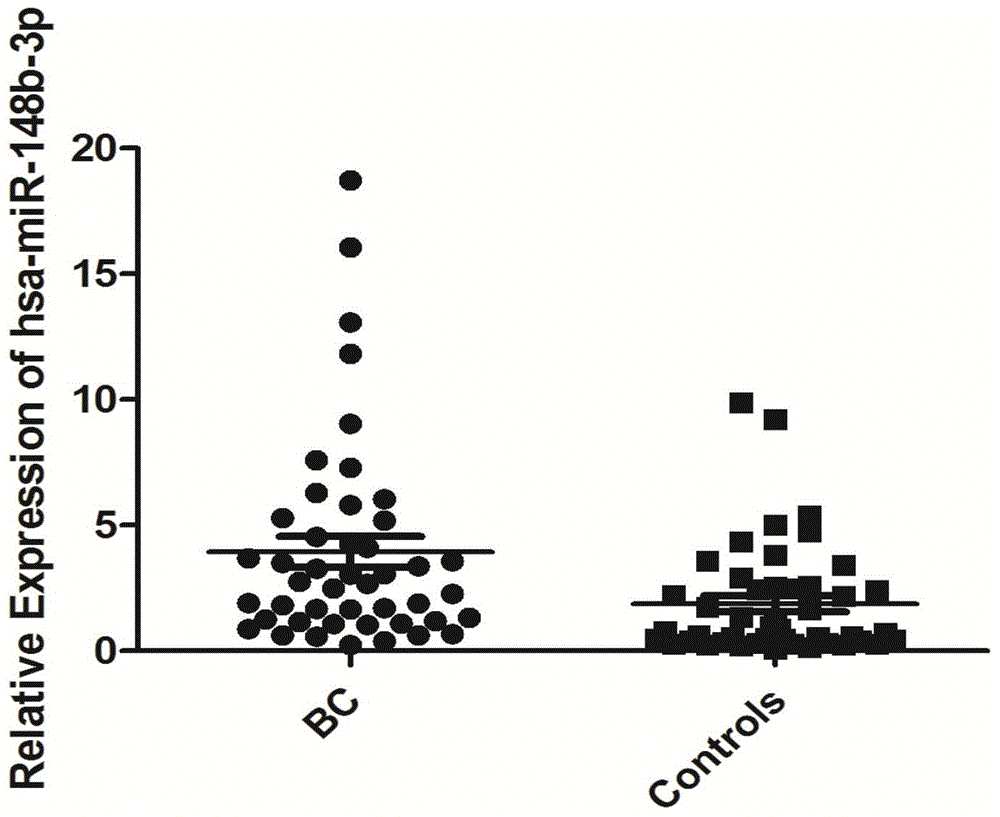 Internal reference substance for detecting bladder cancer serum miRNA and its detection primers and use