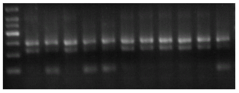 Detection kit and detection method for individualized medication of warfarin