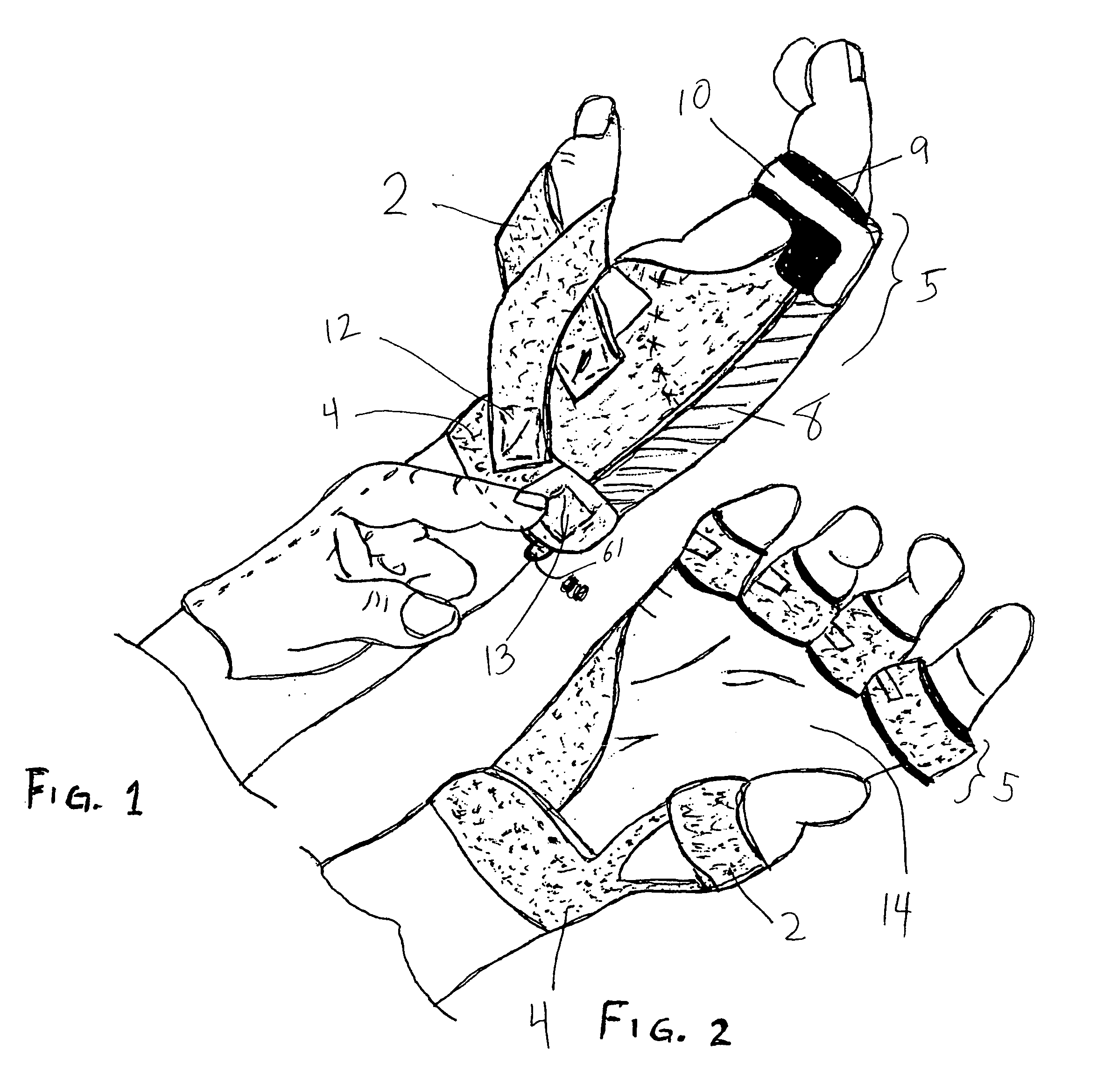 Low-profile, radial nerve splint with interchangeable resilient digit extensor elements and supination adjustment means
