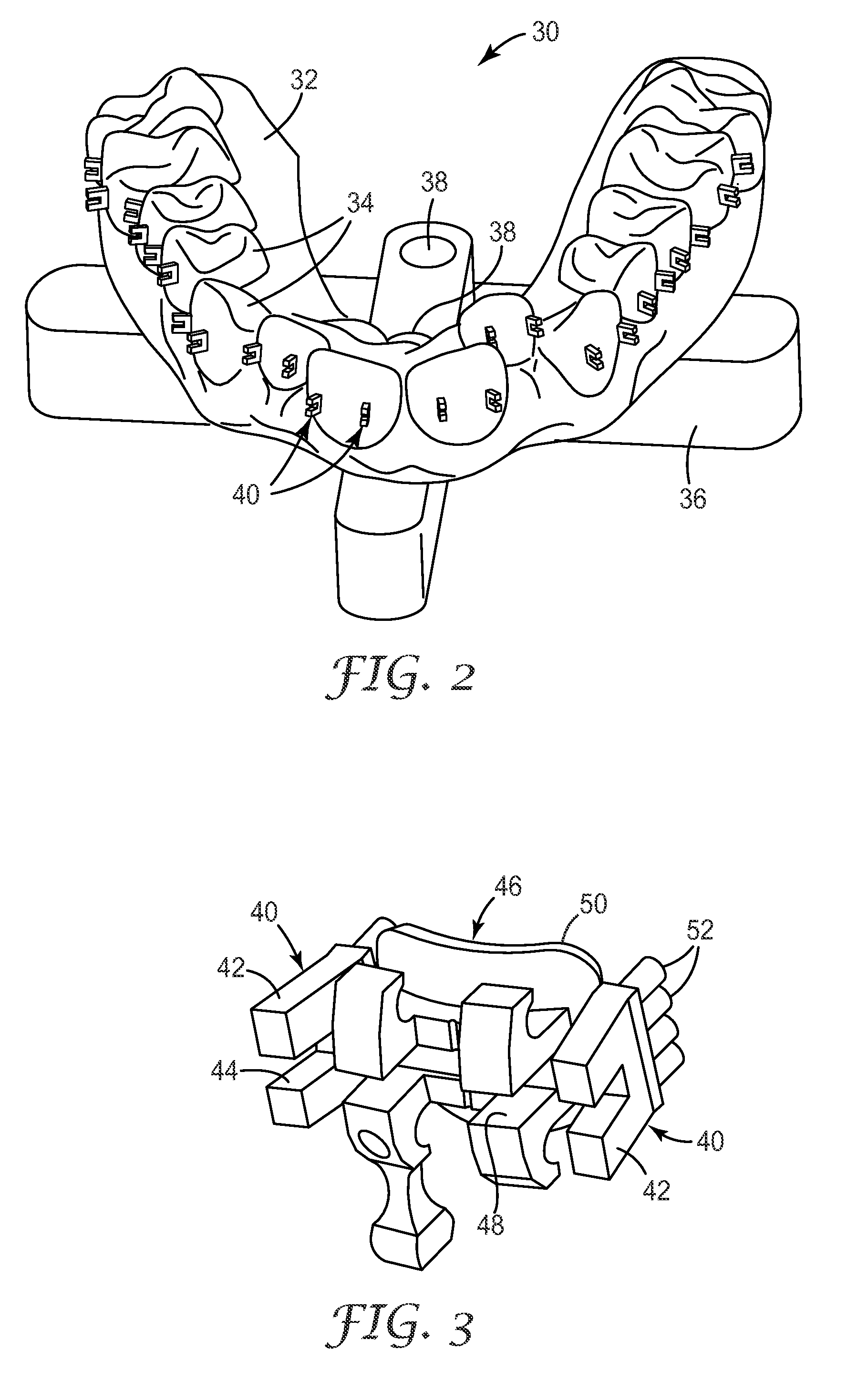 Methods and assemblies for making an orthodontic bonding tray using rapid prototyping