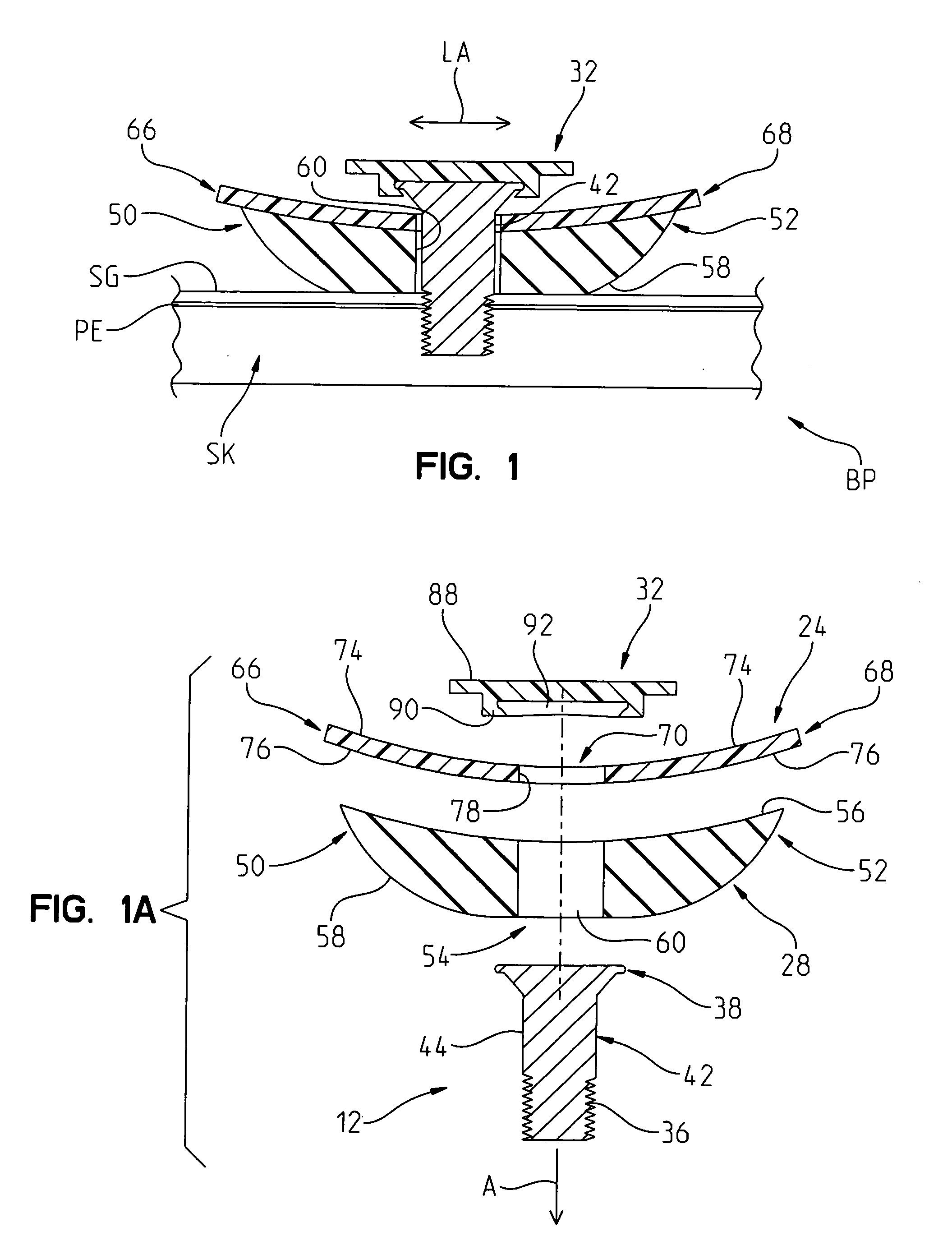 Post Mountable Bandage Device