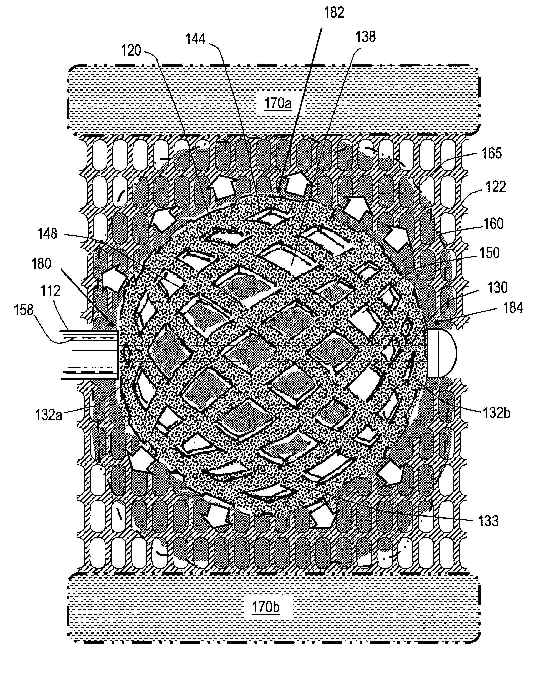 Stent systems and methods for spine treatment