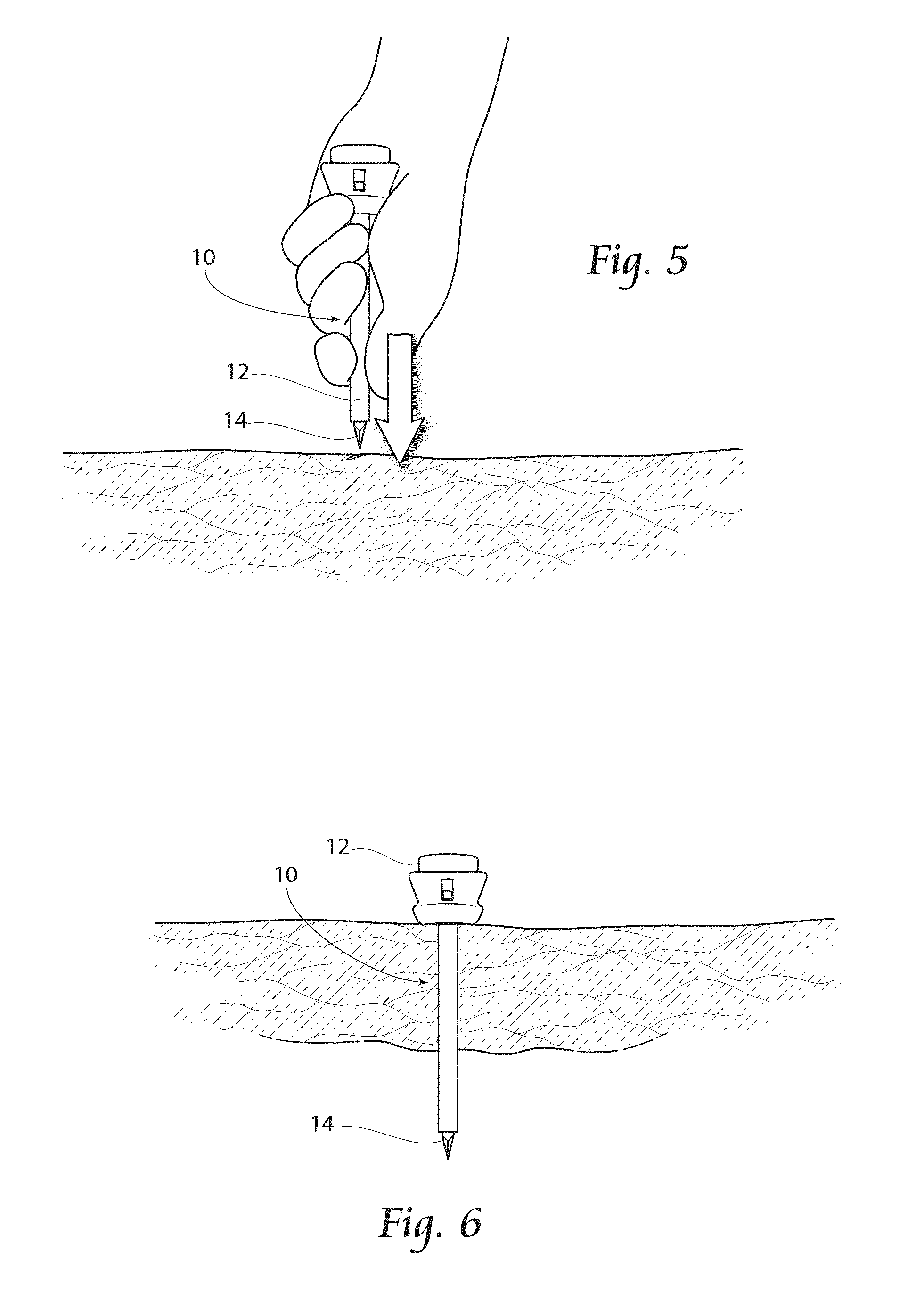 Minimally Invasive Endoscopic/Laparoscopic Highly Absorbent Surgical Devices, Methods and System