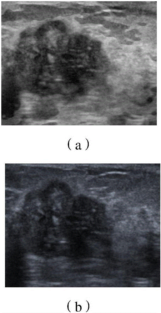 Pathological tissue growth monitoring method and system