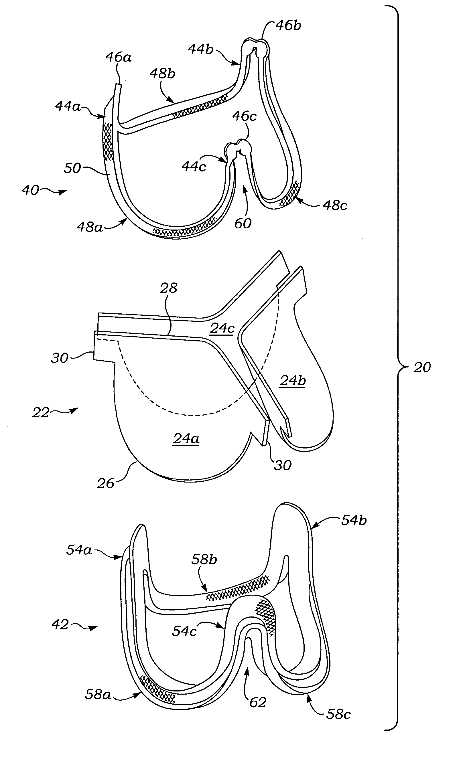Controlled separation heart valve frame