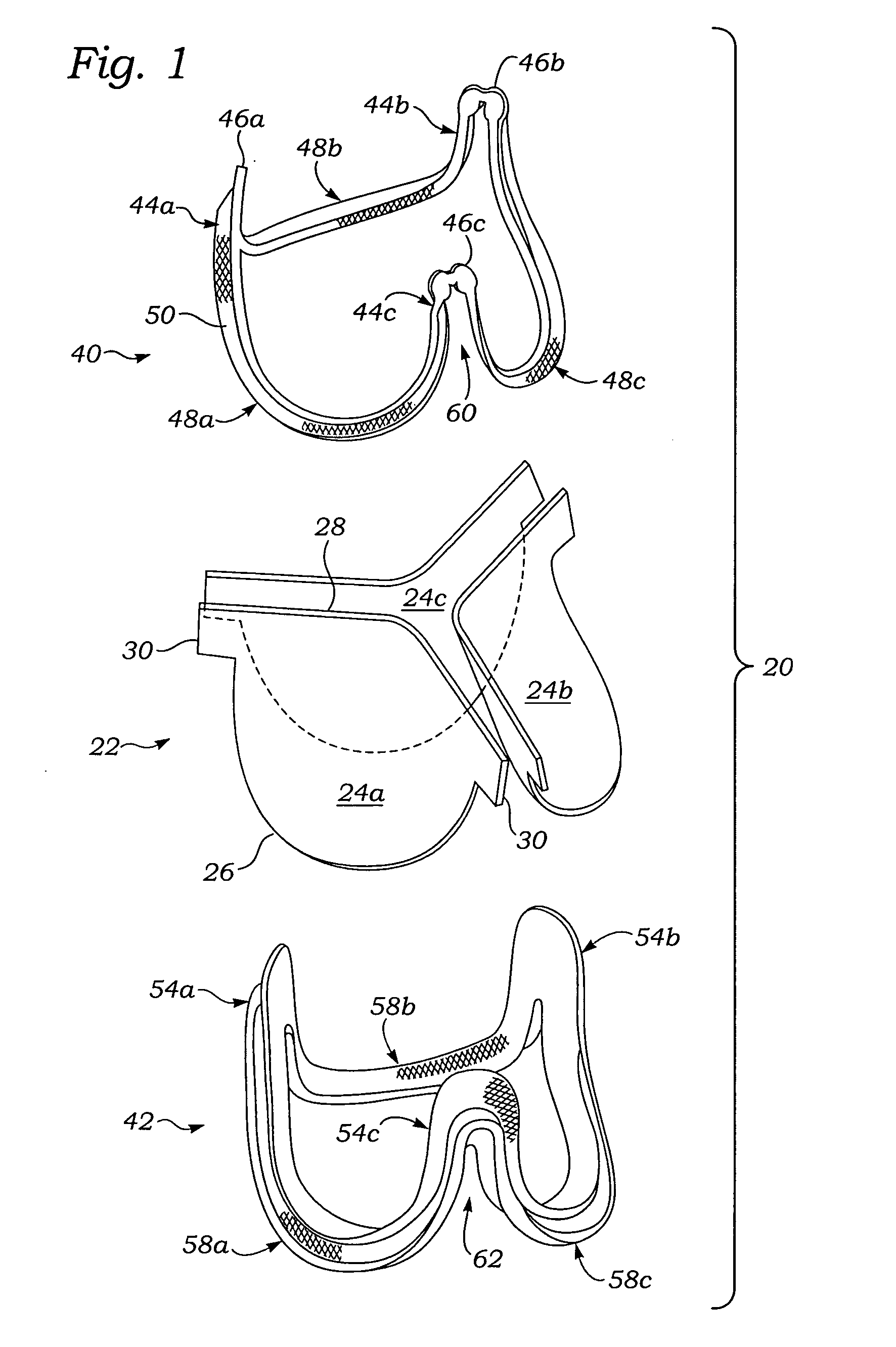 Controlled separation heart valve frame