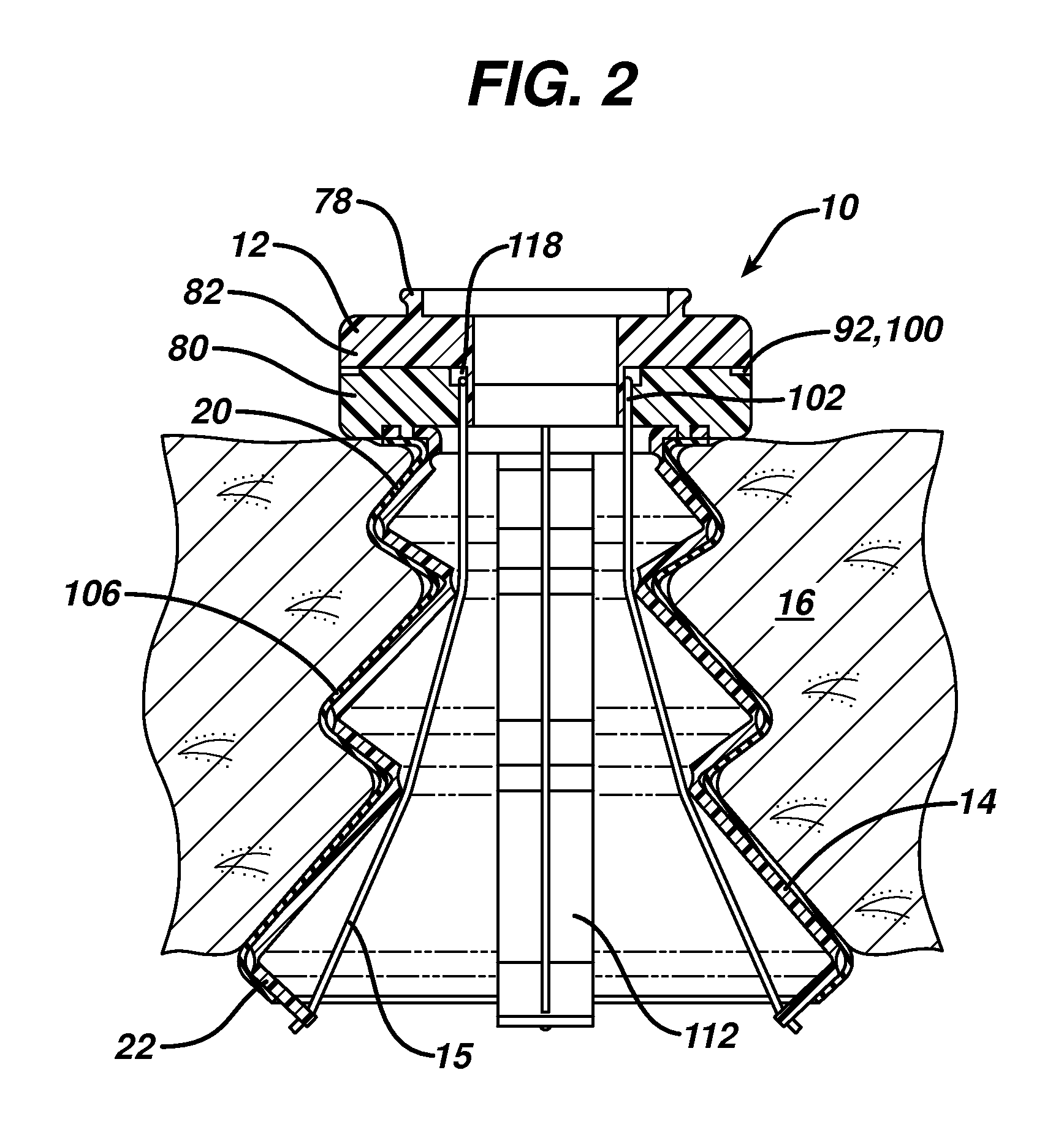 Inverted conical expandable retractor with coil spring