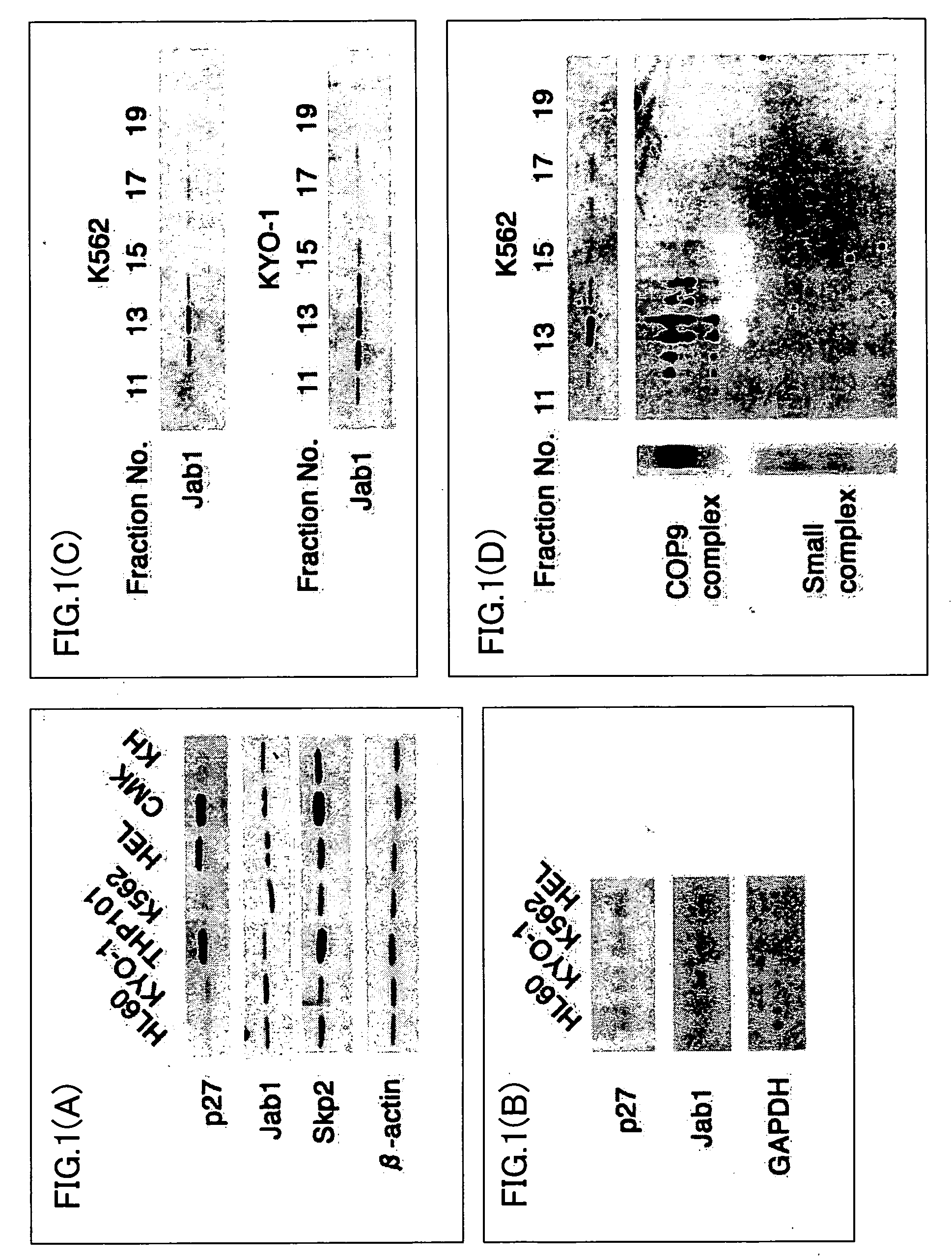 Method of determining efficacy of anticancer drug and determination kit therefor