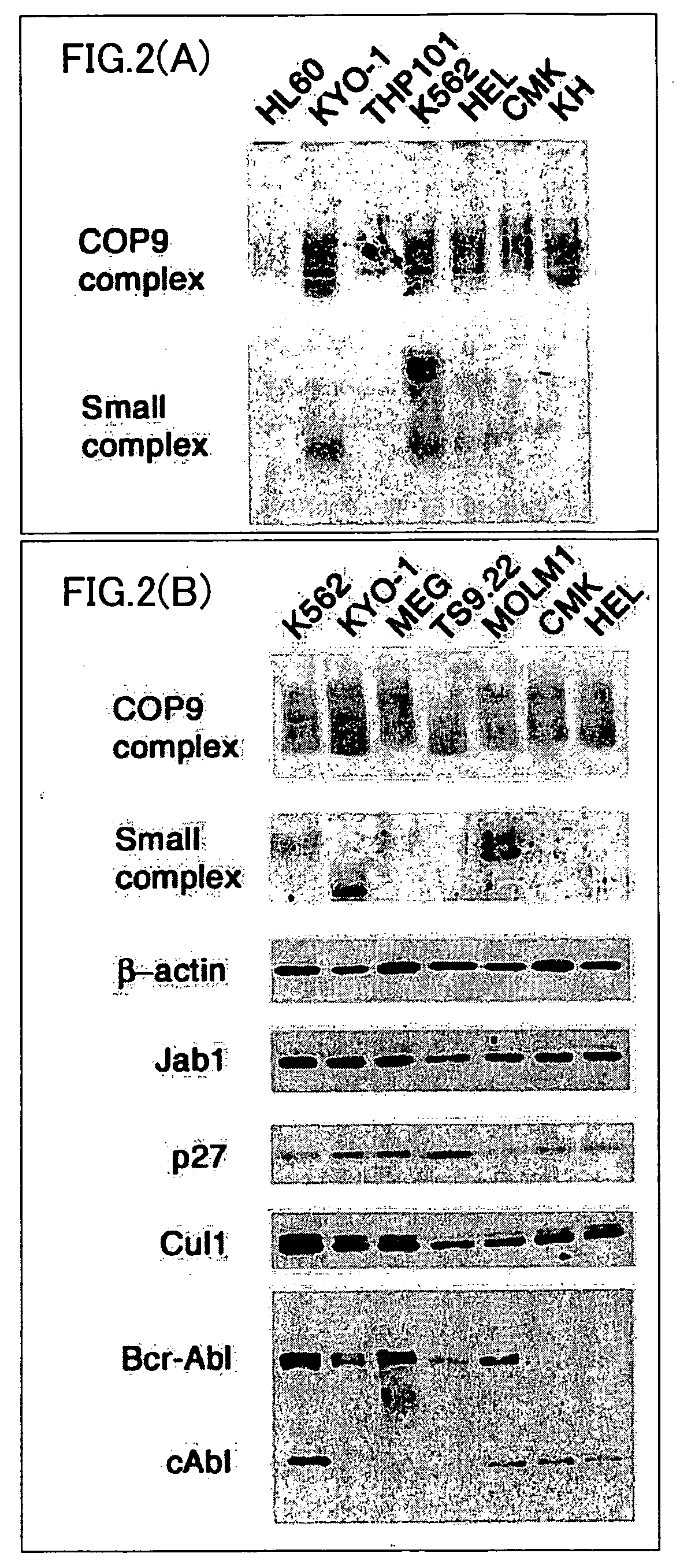 Method of determining efficacy of anticancer drug and determination kit therefor