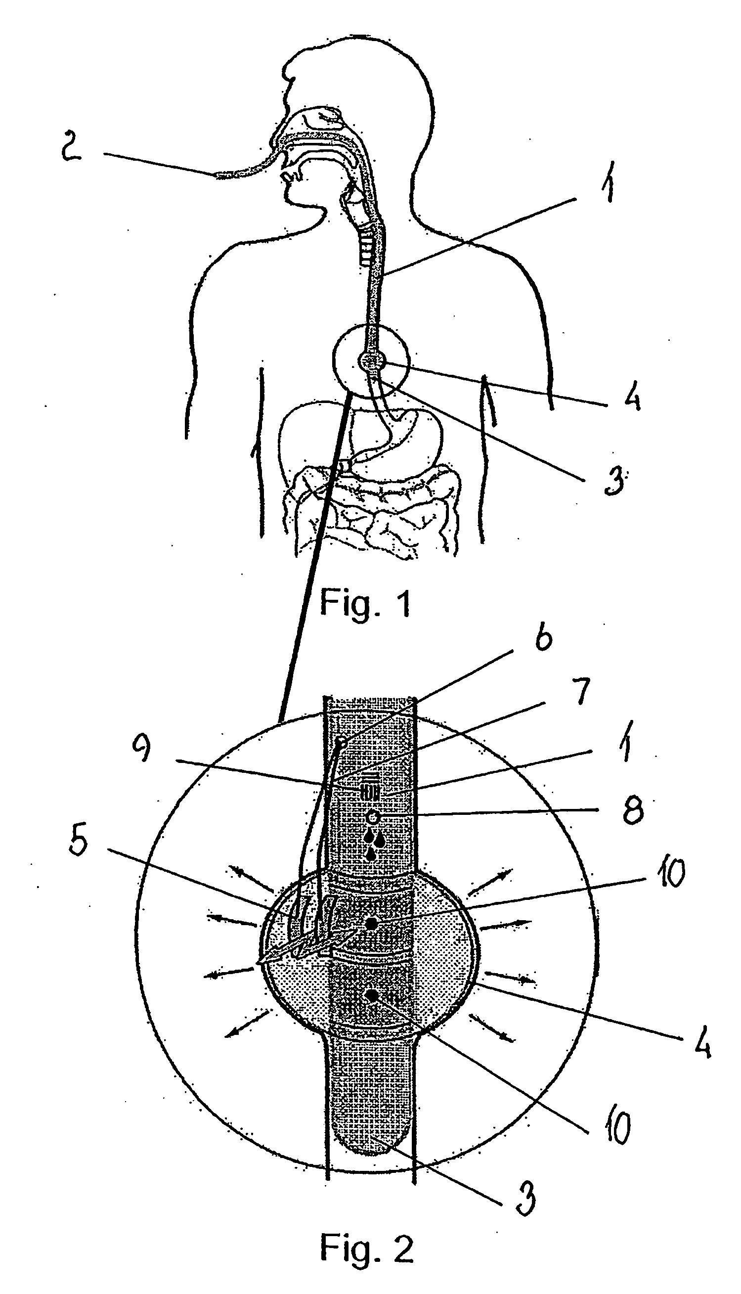 Method and apparatus for stimulating a bodily hollow system and method and apparatus for measuring reactions to stimuli of such system