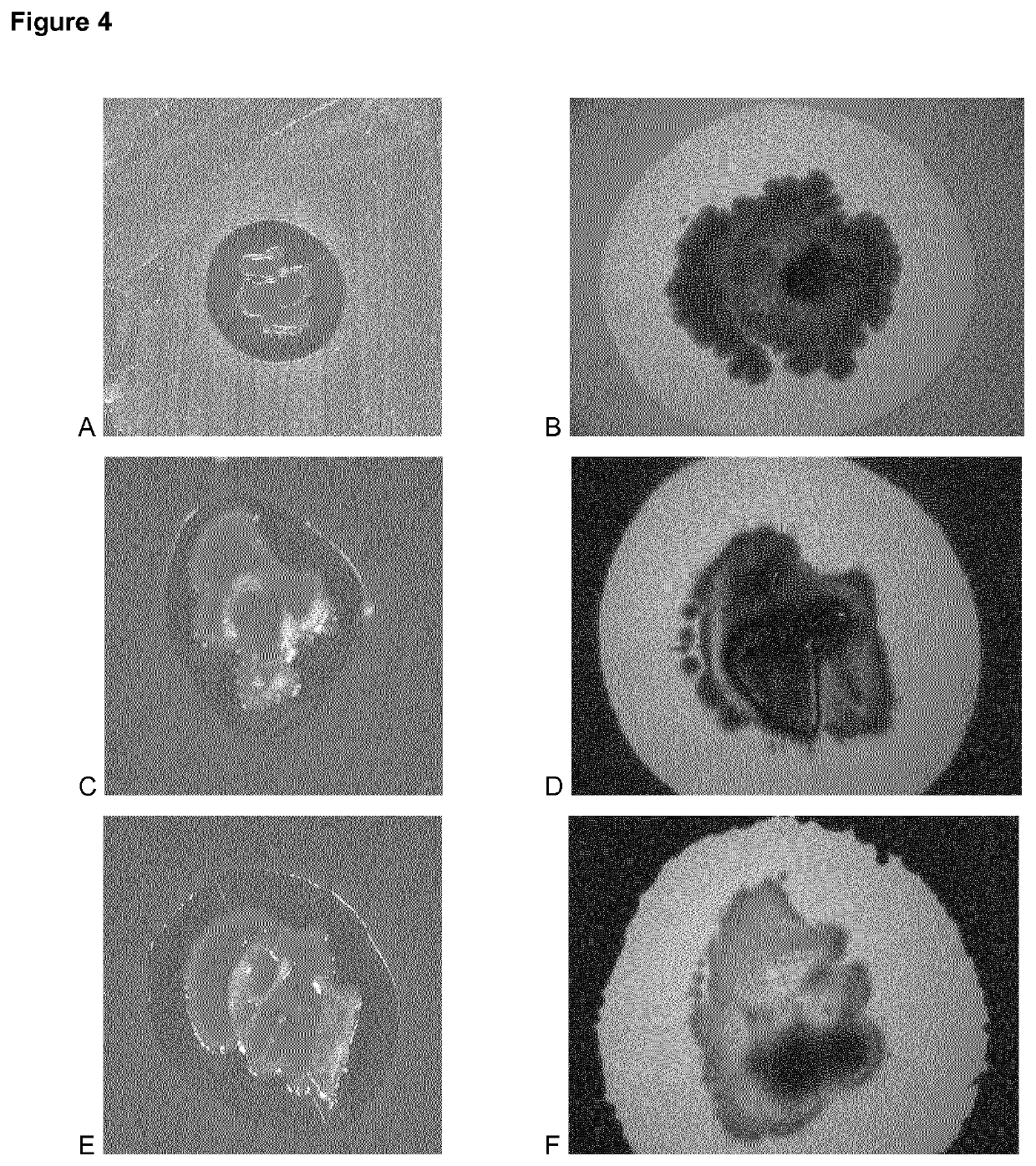 Antimicrobial strain