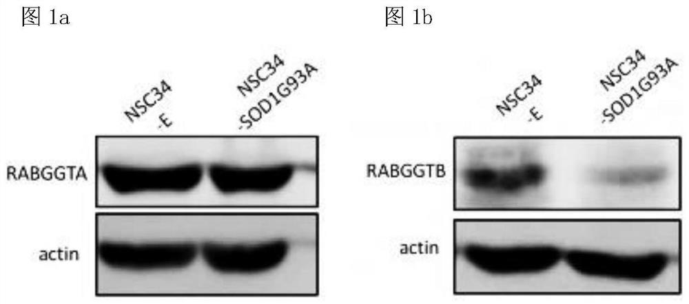 Application of RABGGTB in diagnosis and treatment of amyotrophic lateral sclerosis