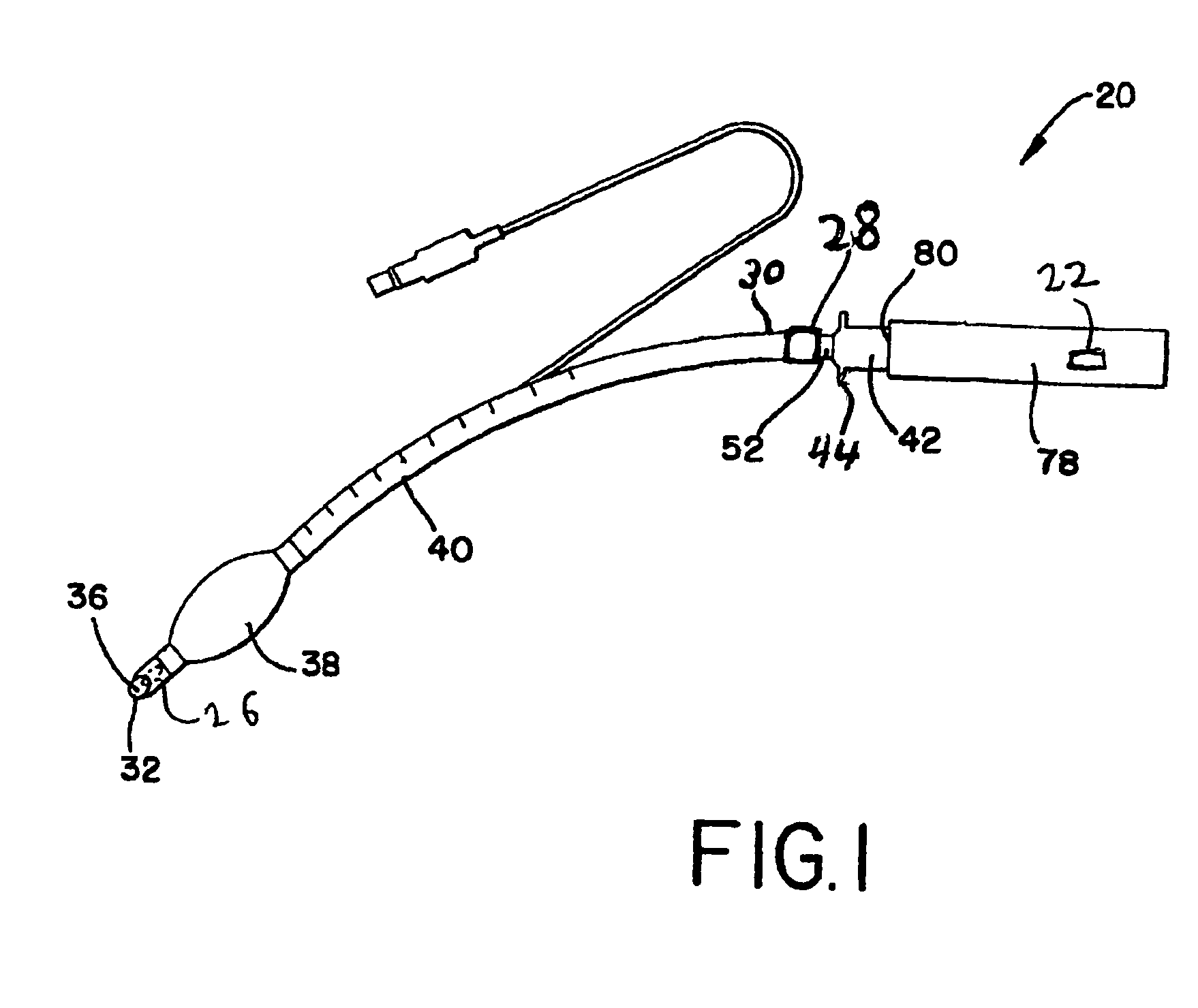 System and method for managing difficult airways