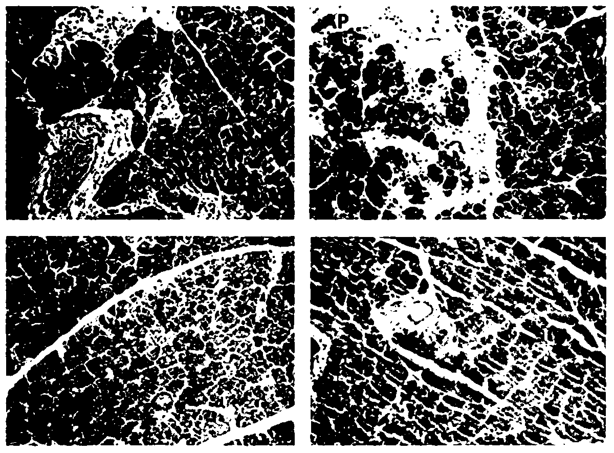 Application of α-lactose in the preparation of medicine for preventing and treating acute pancreatitis