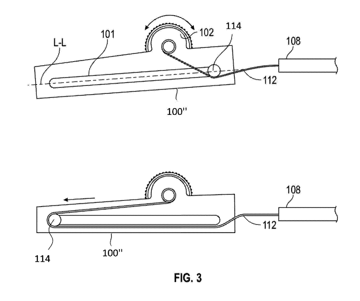 Stent delivery catheter with fast slider and slow thumbwheel control