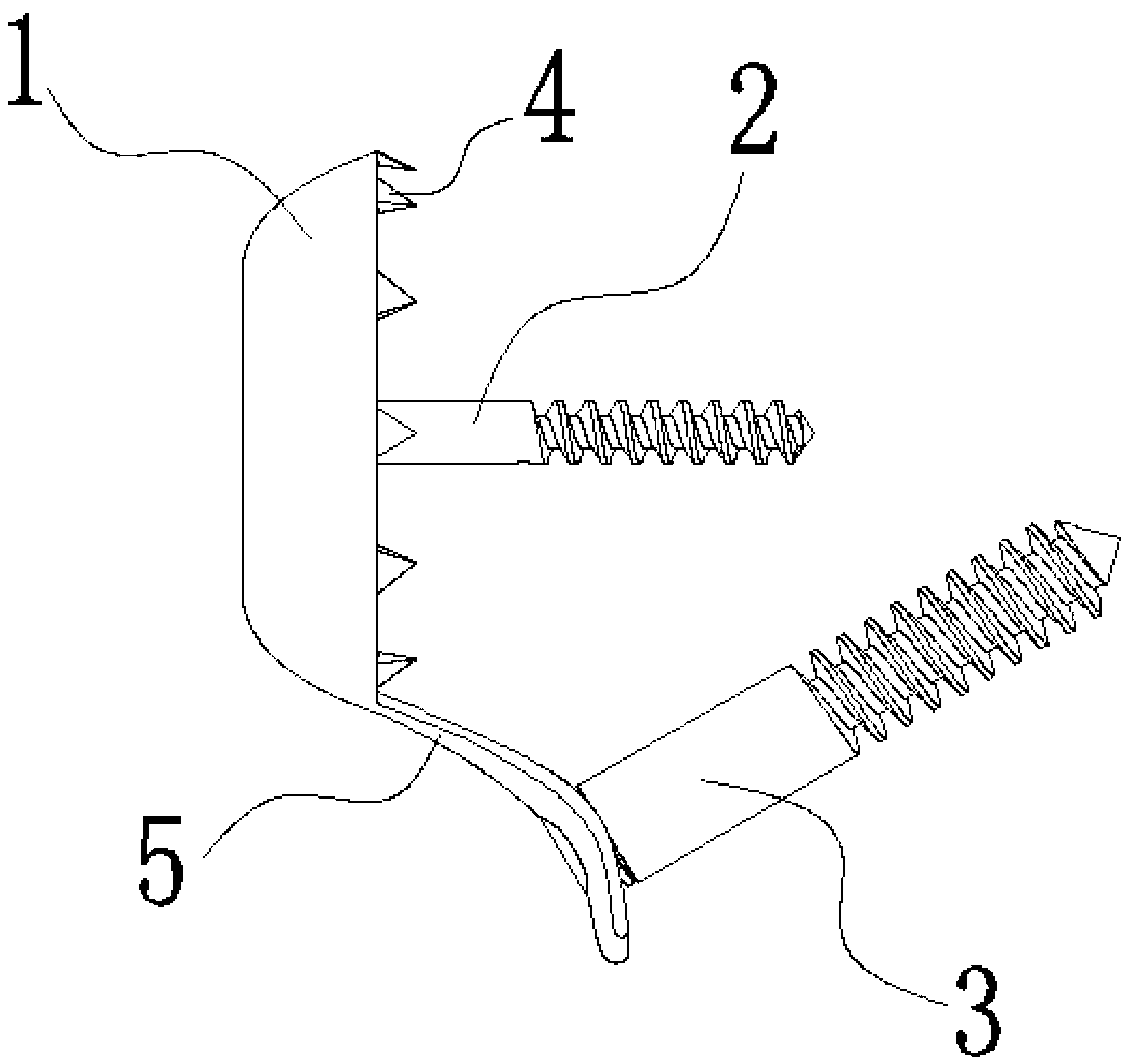 Novel toothed screw pad assembly for cure of avulsion fracture
