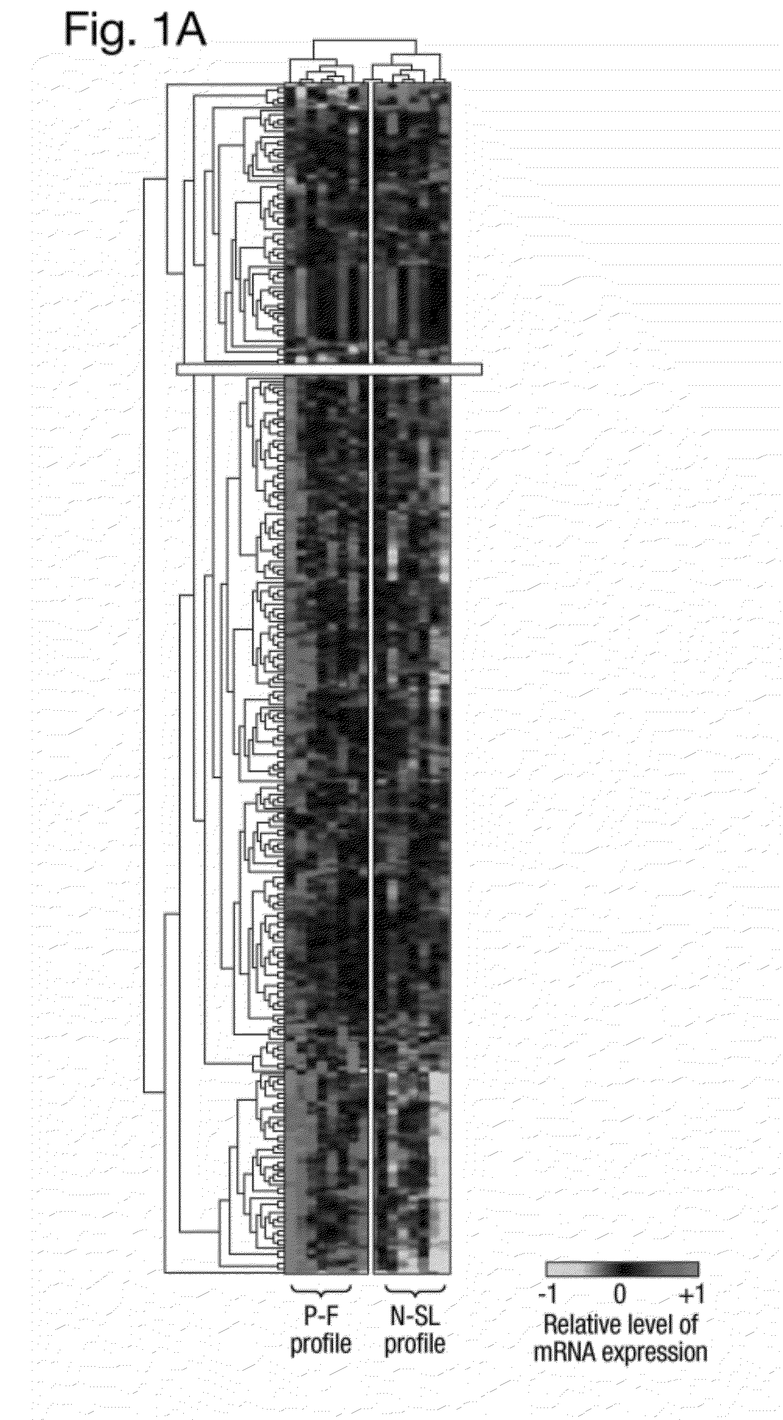 Methods and kits for determining the prognosis of pulmonary sarcoidosis