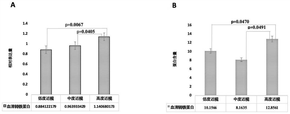 Iron metabolism-related protein marker composition and application thereof for risk prediction of high myopia and auxiliary diagnosis of high myopia