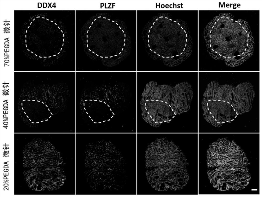 In vitro culture method and application of testicular tissue based on microneedles