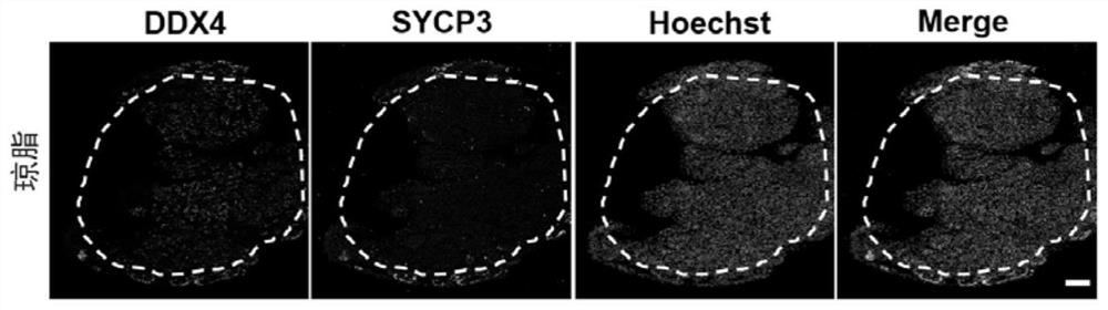 In vitro culture method and application of testicular tissue based on microneedles