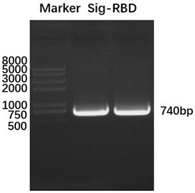 Novel coronavirus Brazilian strain p.  1 The gene of mutant rbd and its application