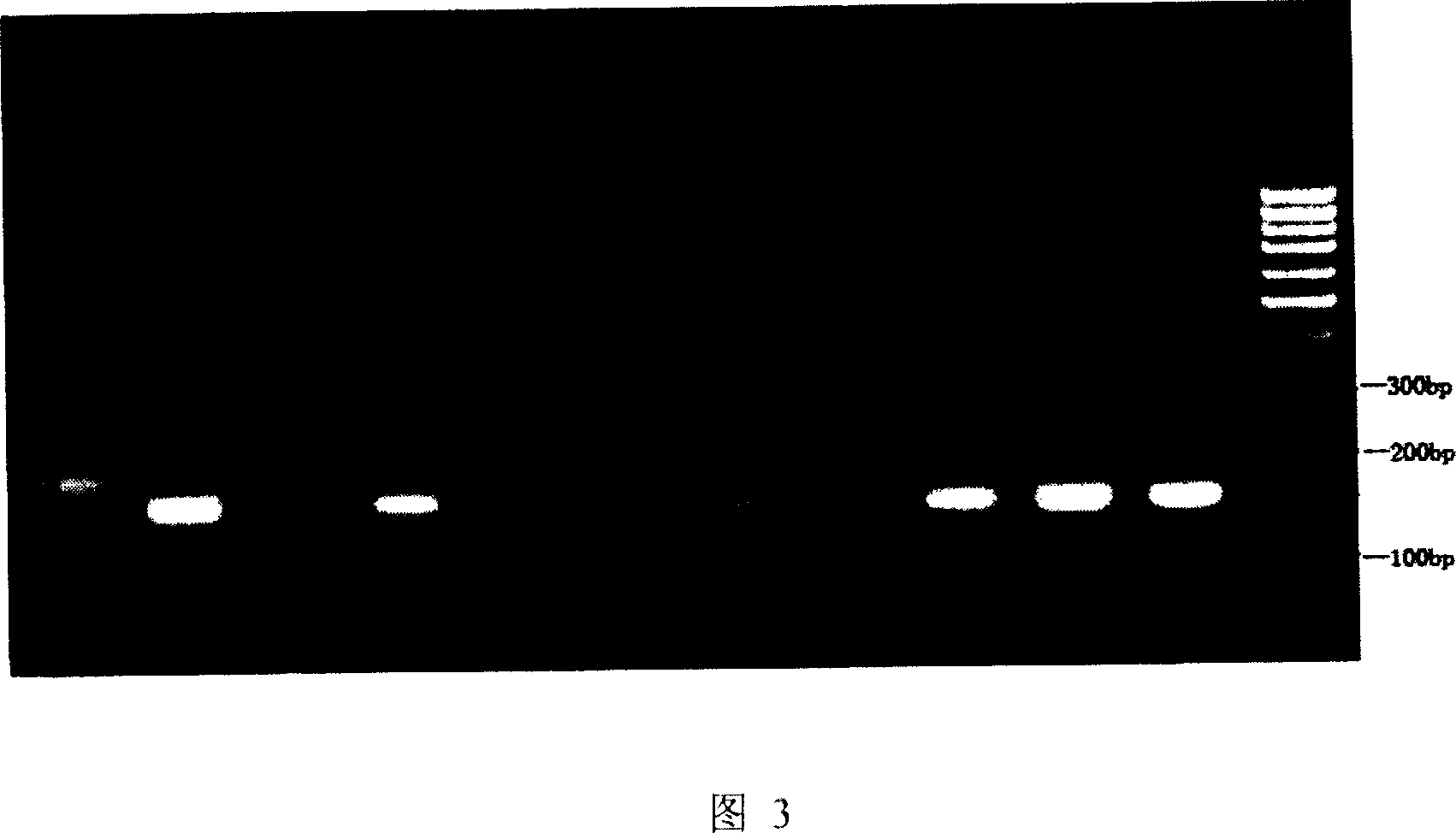 Primer and method for quickly detecting IT15 gene CAG repeat sequence dynamic mutation