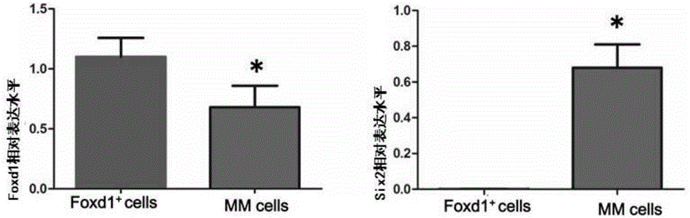 Preparation method of metanephric mesenchyme cells