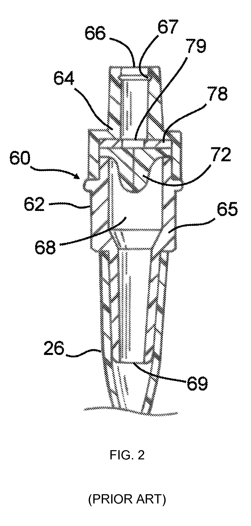 Tapered attachment for pleural catheter