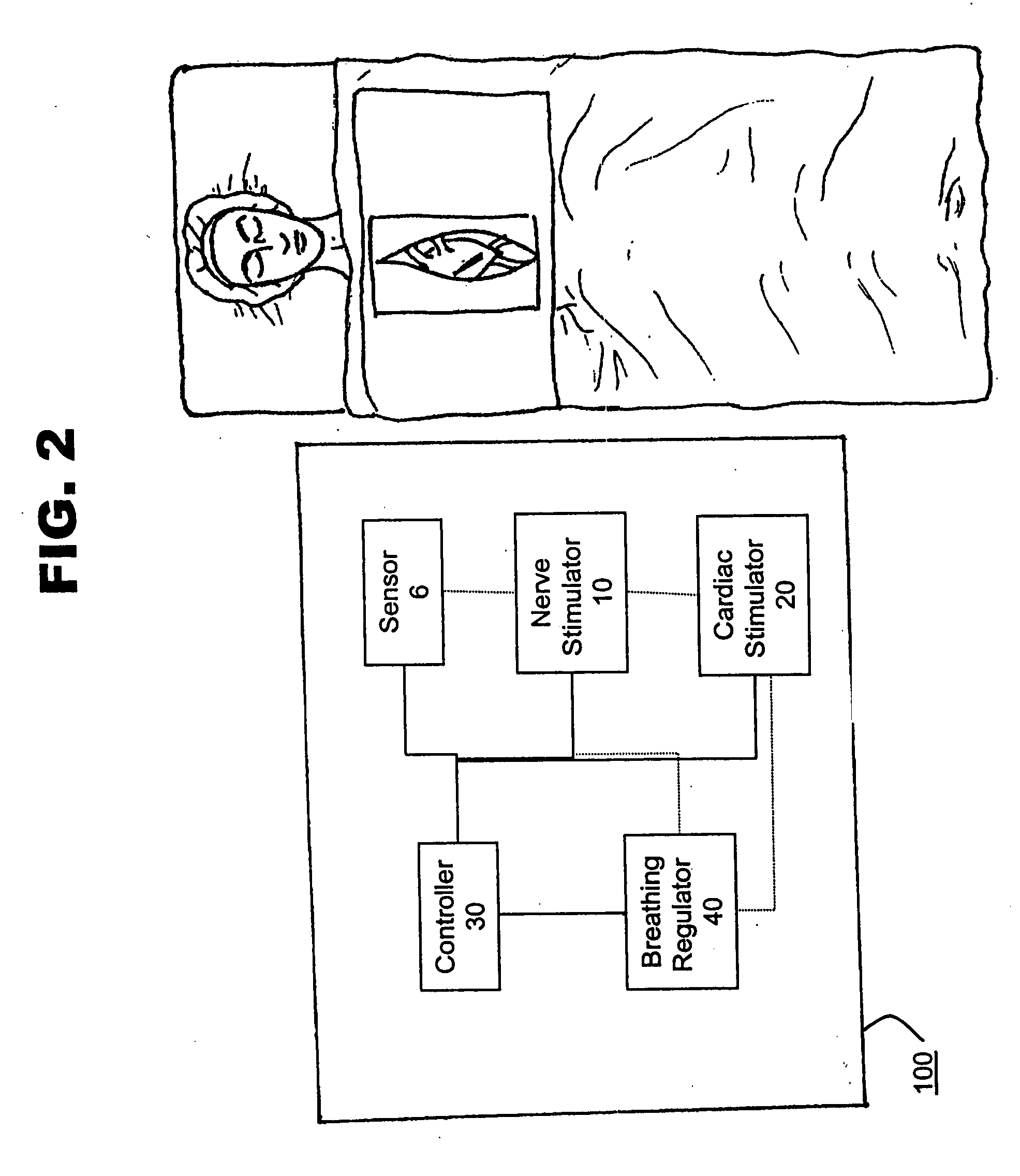 Method and system for nerve stimulation and cardiac sensing prior to and during a medical procedure