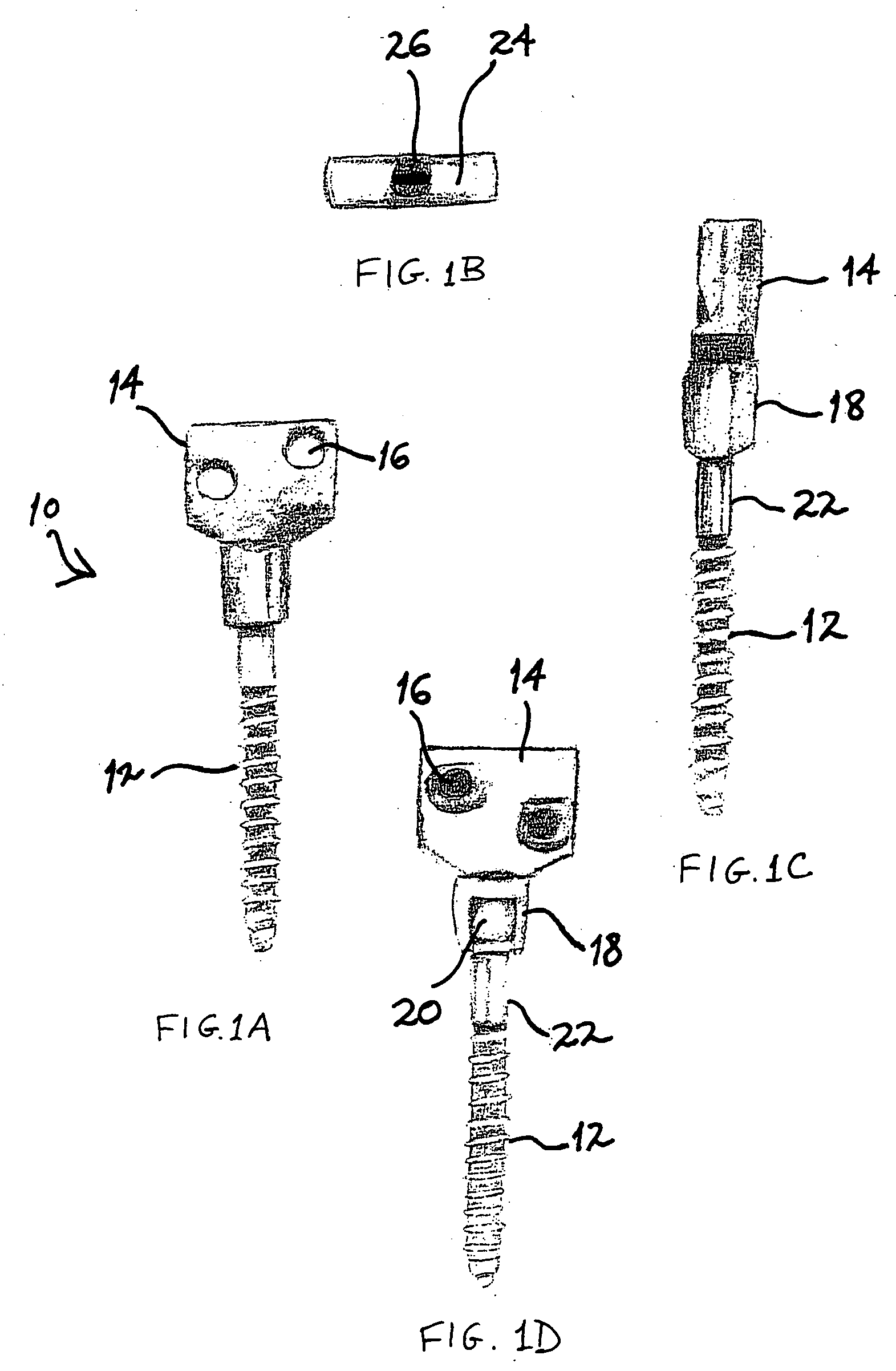 Facet joint prosthesis and method of replacing a facet joint