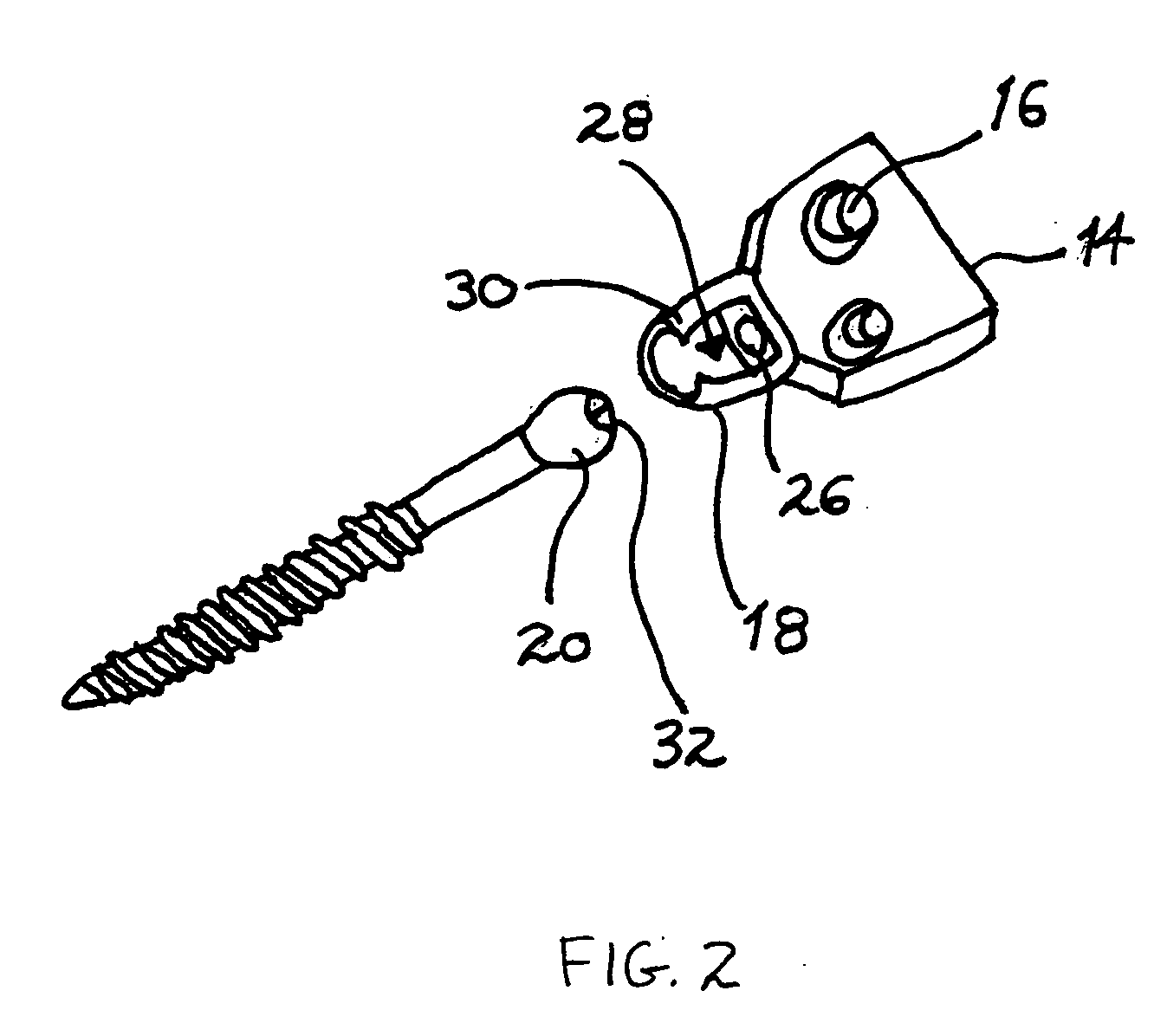 Facet joint prosthesis and method of replacing a facet joint