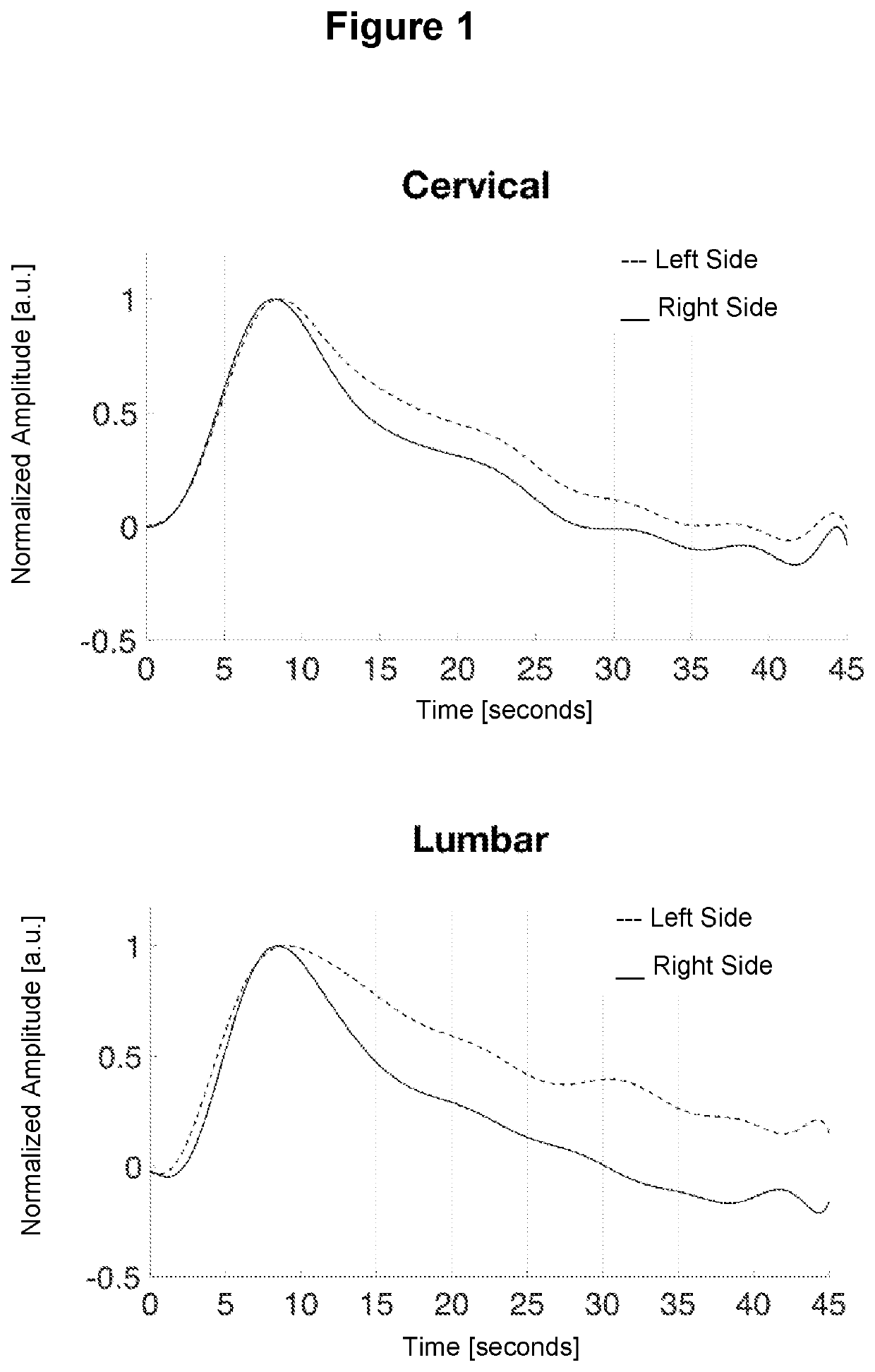 Device for recording the vascular response of the human spinal cord triggered by a suprasensible stimulus through the use of functional near-infrared spectroscopy