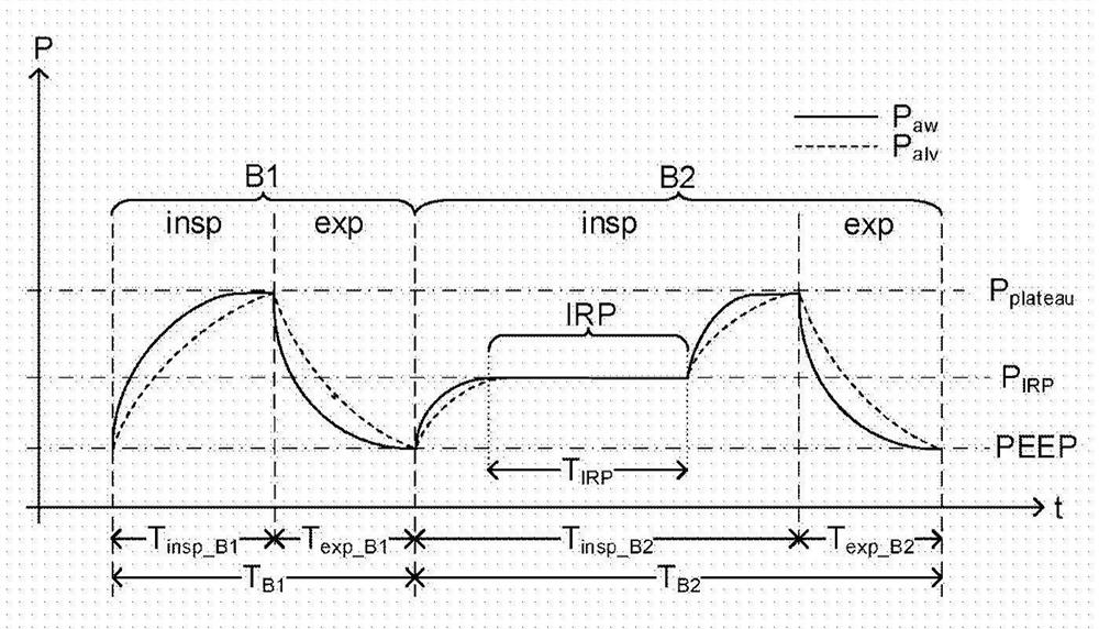 Ventilation pattern for hemodynamic parameter determination during mechanical ventilation