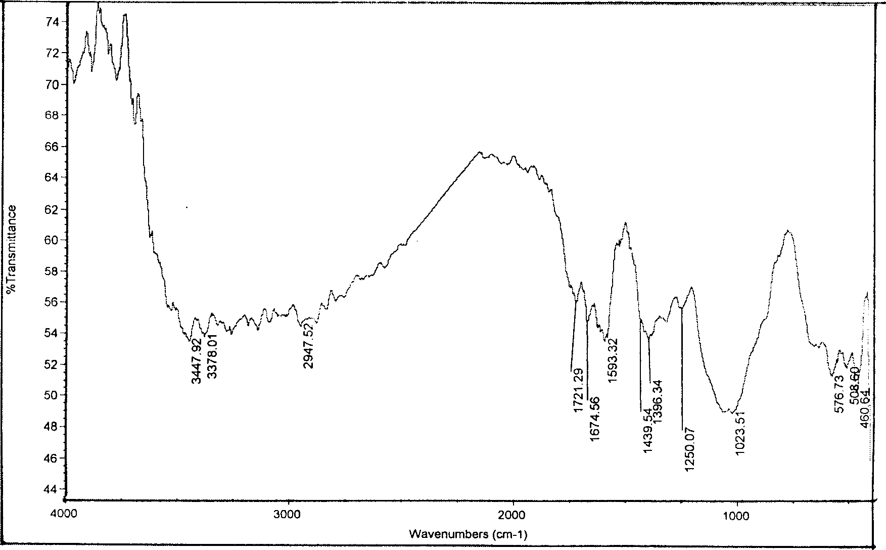 Synthesis process of carbamido carboxymethyl chitosan