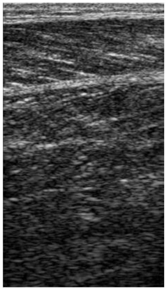 Method for detecting lower muscular fascia and included angle between lower muscular fascia and muscle fiber based on B-mode ultrasound image