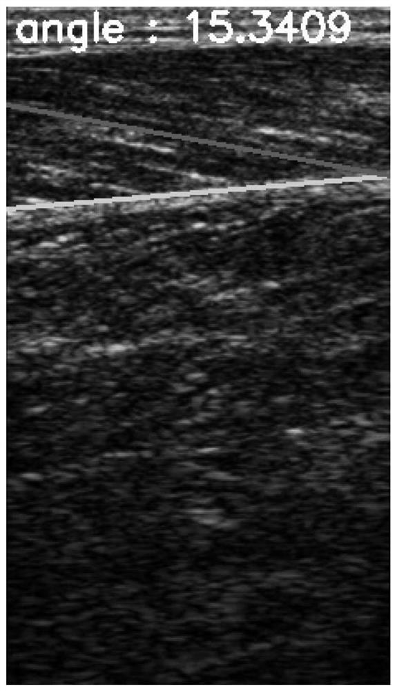 Method for detecting lower muscular fascia and included angle between lower muscular fascia and muscle fiber based on B-mode ultrasound image