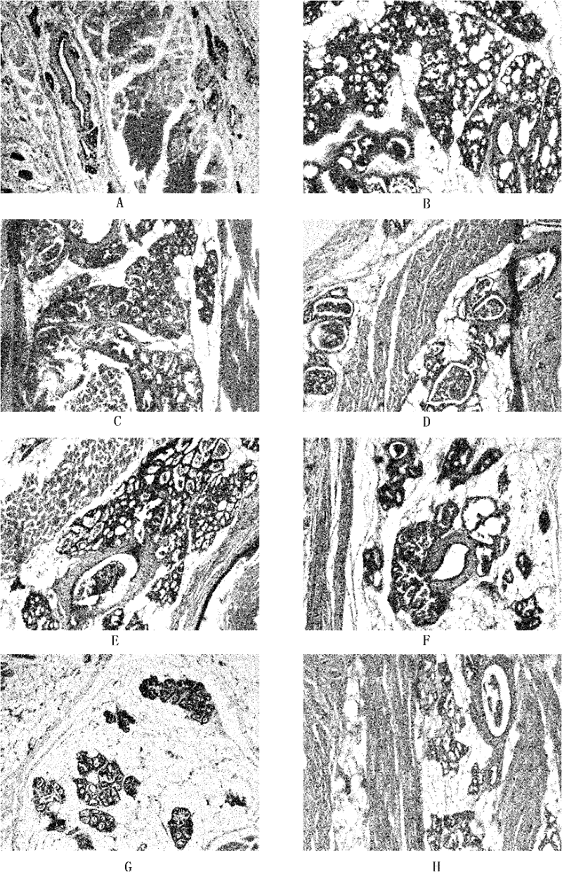 Cream preparation for preventing and curing mammary gland hyperplasia and preparation method thereof