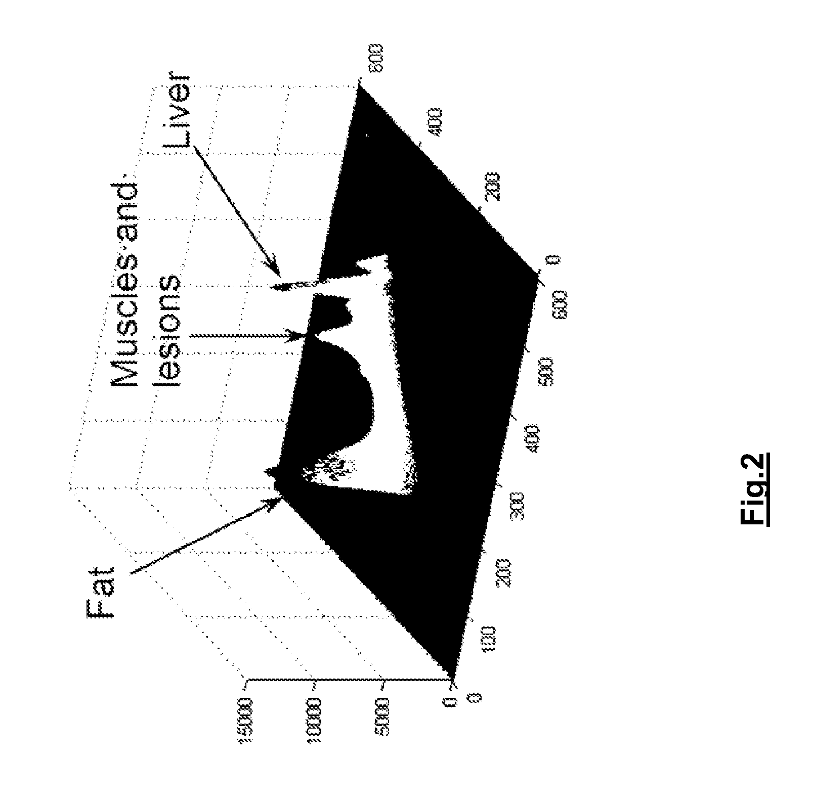 Method and system for lesion segmentation