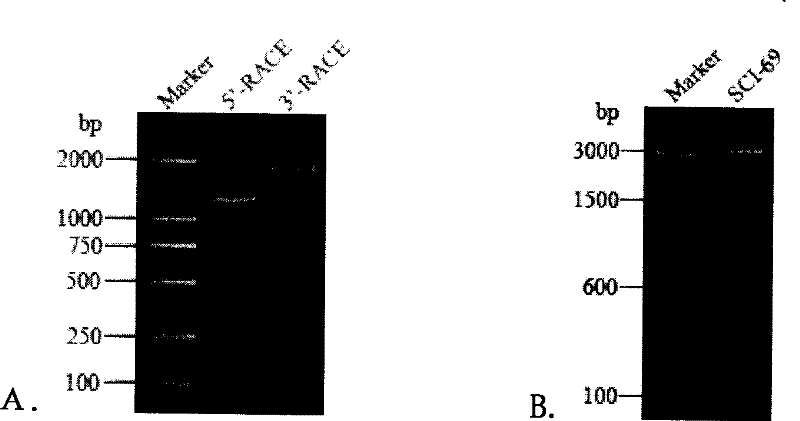 SCIRR69 gene, regulation BDNF transcription and application in biomedicine research, biological therapeutic research and invention