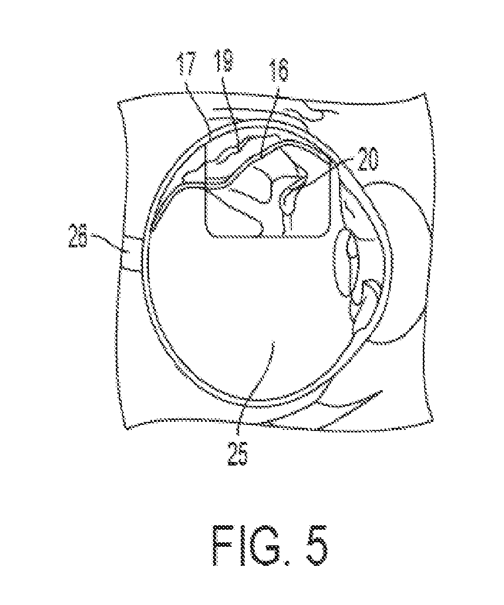 Minimally-invasive method and apparatus for restructuring the retina