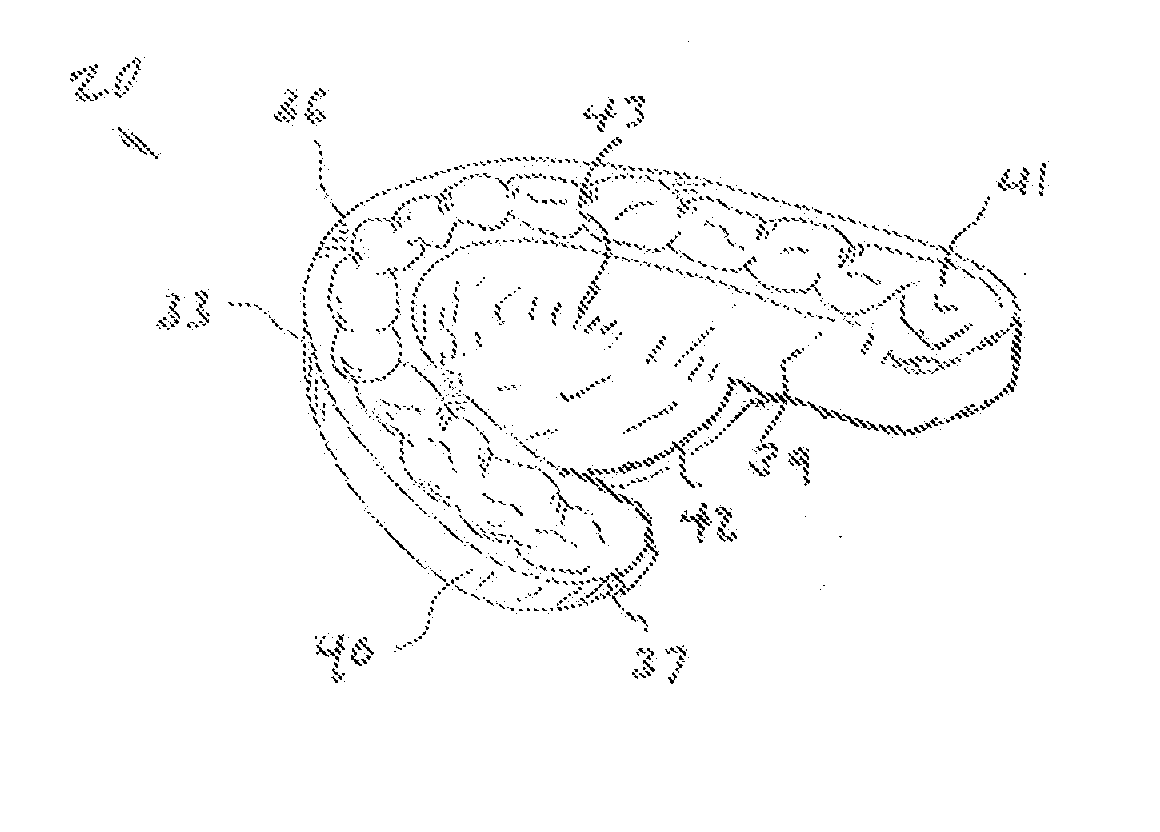 Intraoral device for treatment of snoring, sleep apnea and tmd