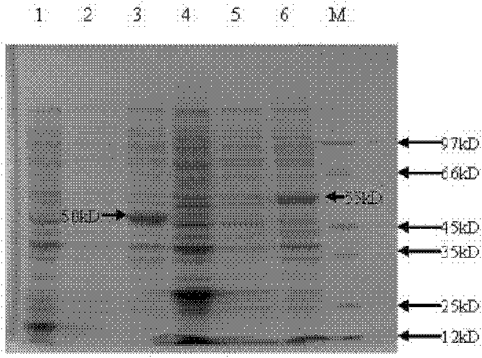 Monoclonal antibody with liver cancer resisting activity and application thereof