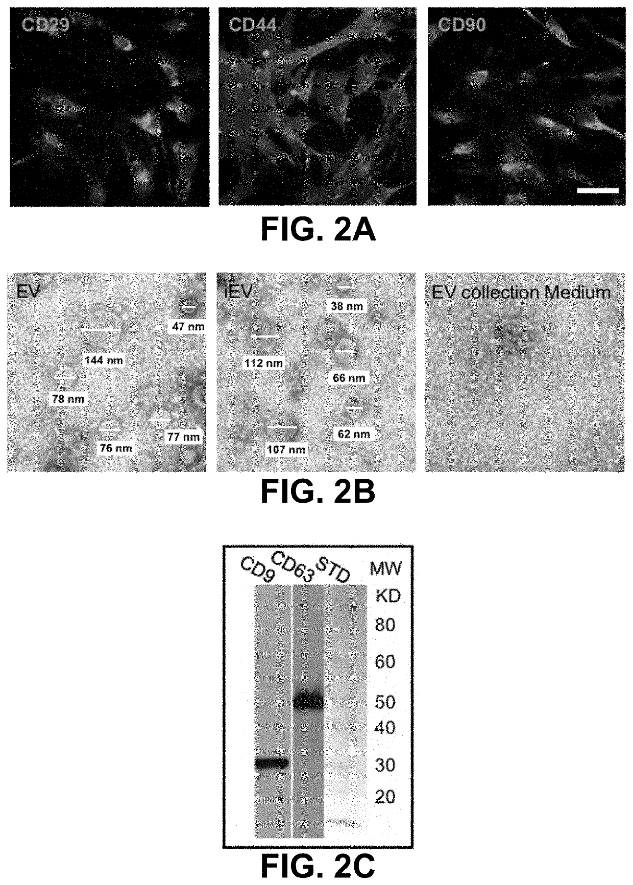 Stem cell-derived extracellular vesicles and methods of use thereof