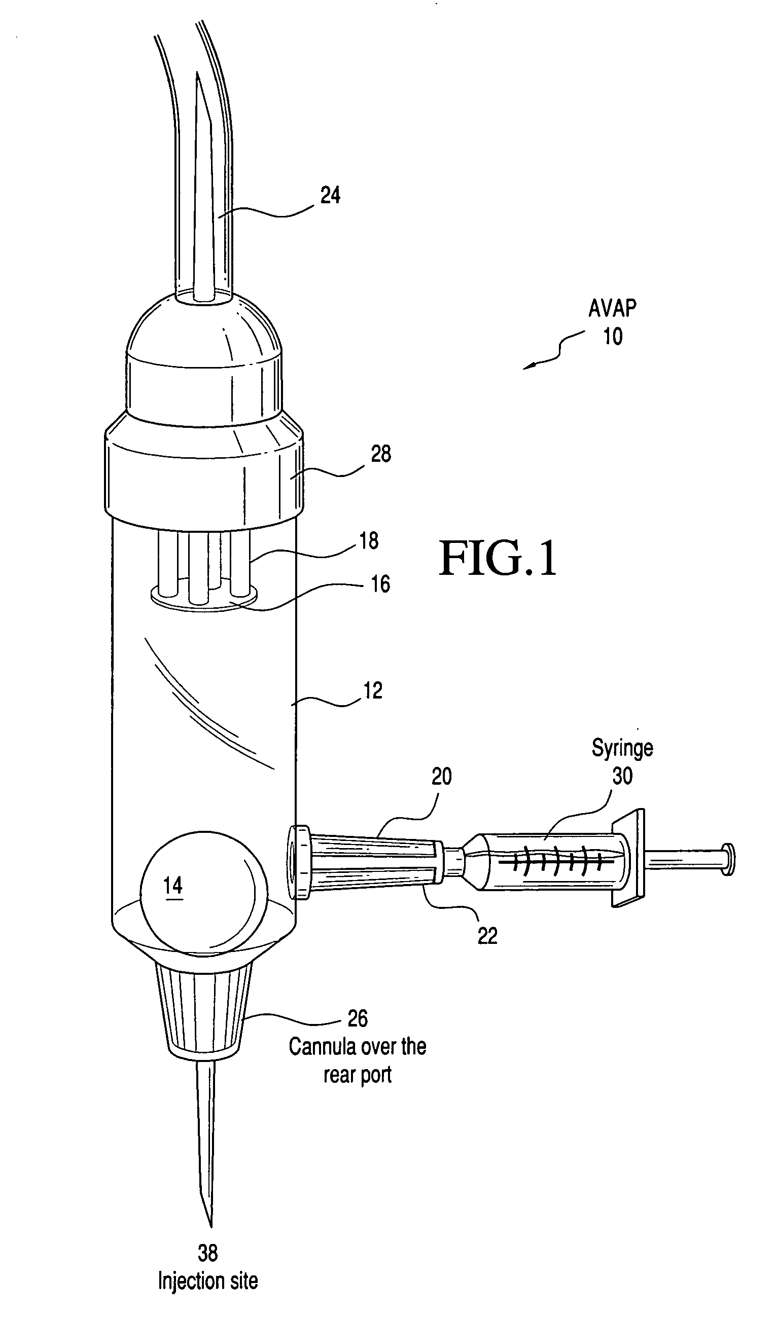 AVAP: air valve and port for intravenous (IV) tubing