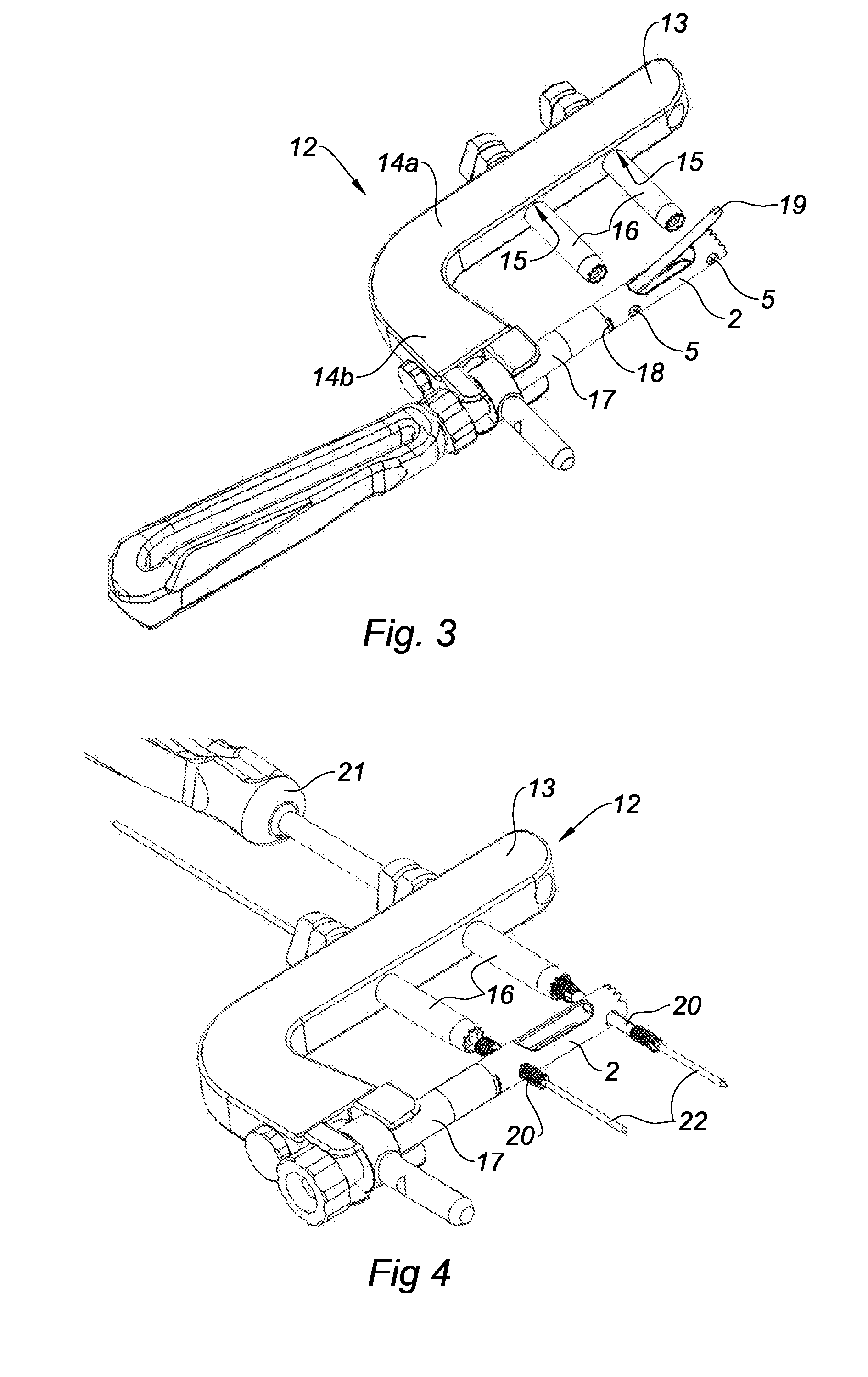 Osteosynthesis pin